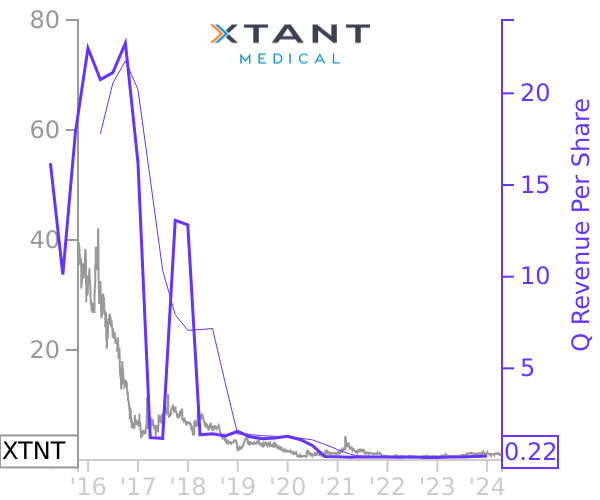 XTNT stock chart compared to revenue