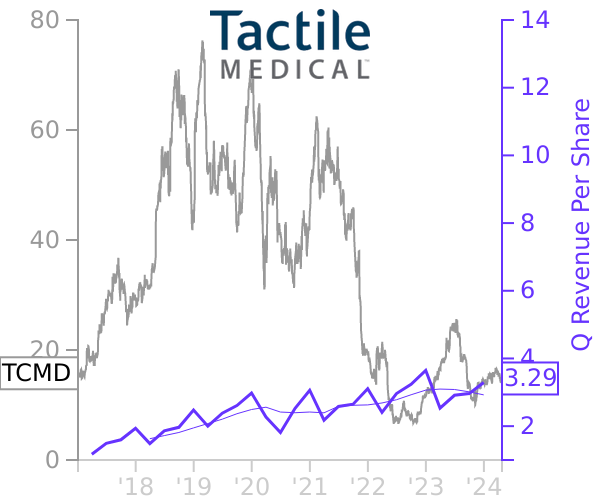 TCMD stock chart compared to revenue